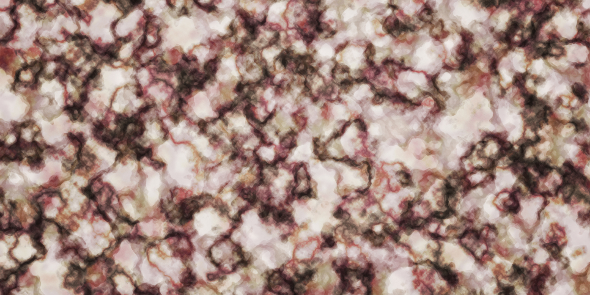 The Rising Trend Of Buying Gold Bars: A Complete Information