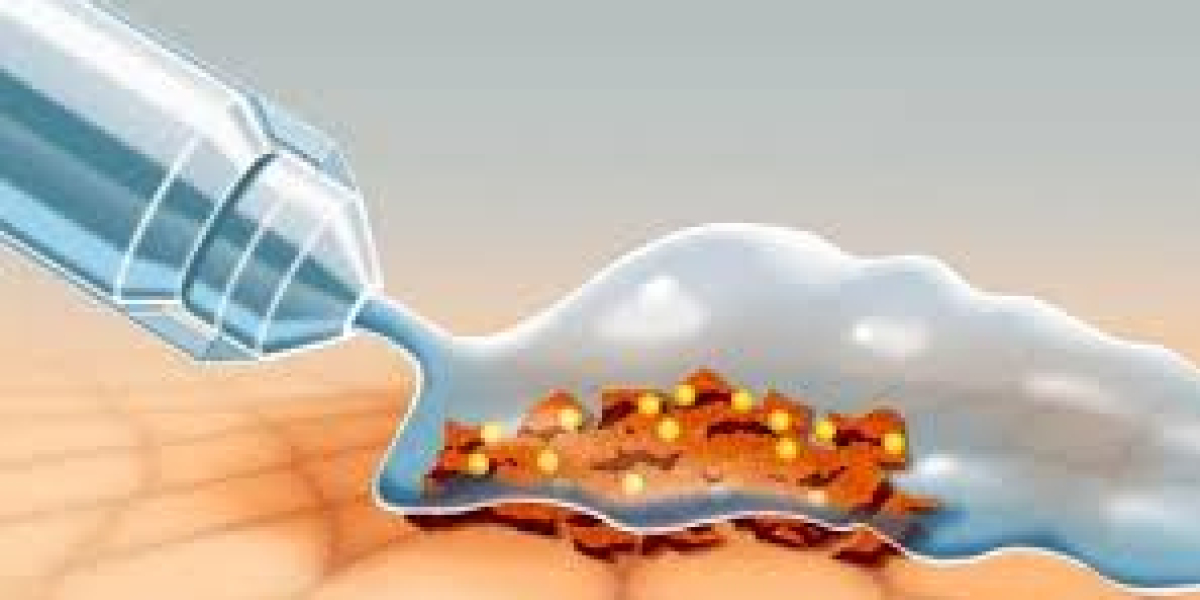 Wound Irrigation Systems Market Set to Witness Strong Growth Driven by Advanced Wound Care Technologies
