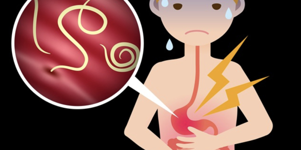Foods That Fight Off Worm Parasites