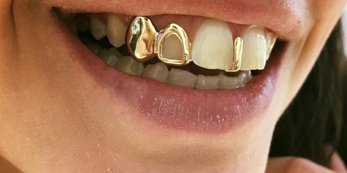 Gold Teeth express luxury attitude through powerful golden shine