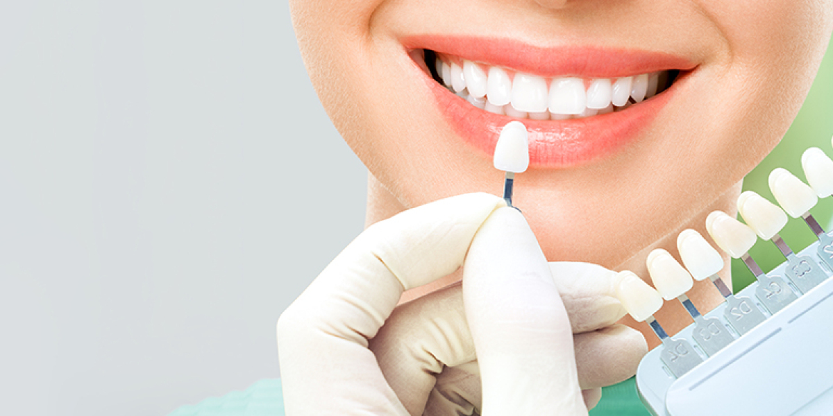 Cosmetic Dentistry Everything You Need to Know