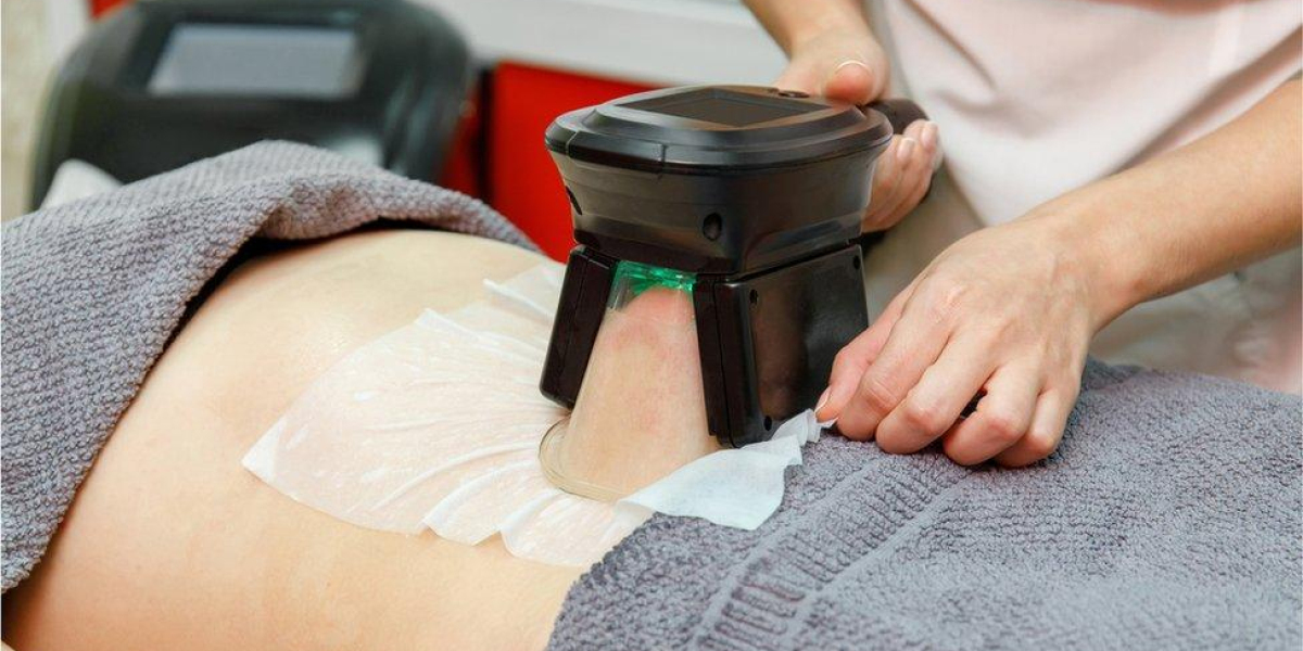 How CoolSculpting Can Boost Confidence and Self-Esteem