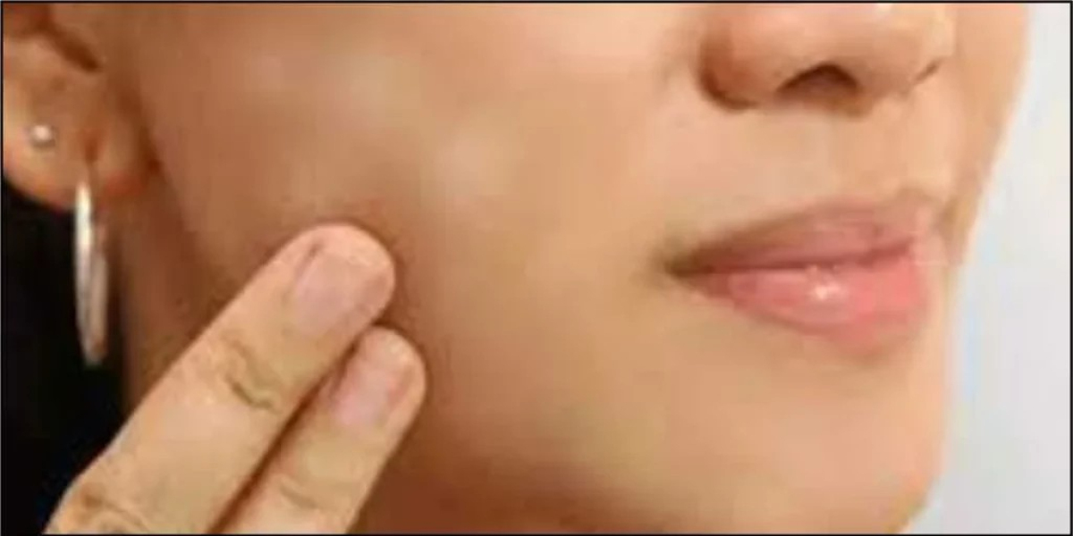 Signs of Vitiligo Recovery | Vitiligo Diet Chart – Kaya Kalp Global