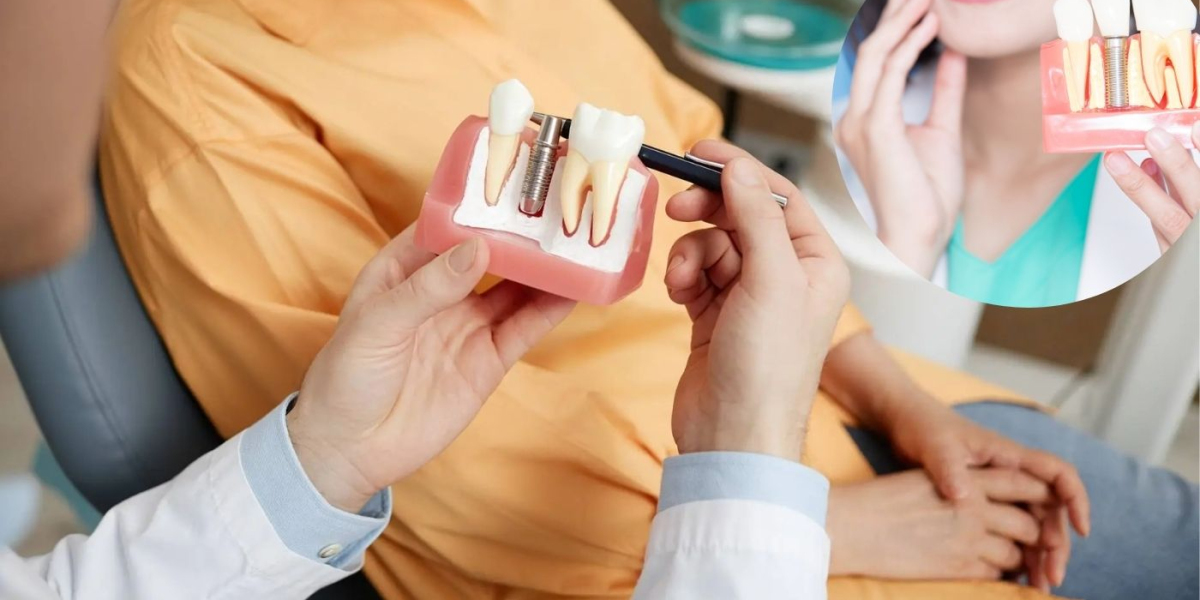 Best Dental Clinic in Pune | Dental Implants & Root Canal