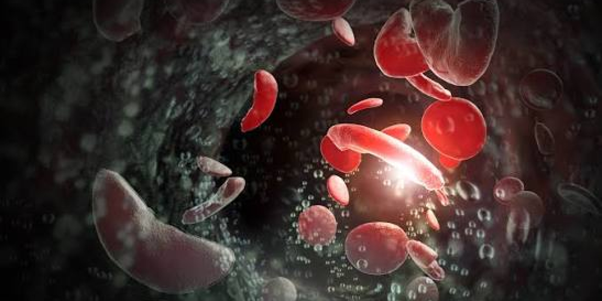 Sickle Cell Disease Treatment Market Insights: Advances in Gene Editing and Personalized Medicine Boost Market Expansion