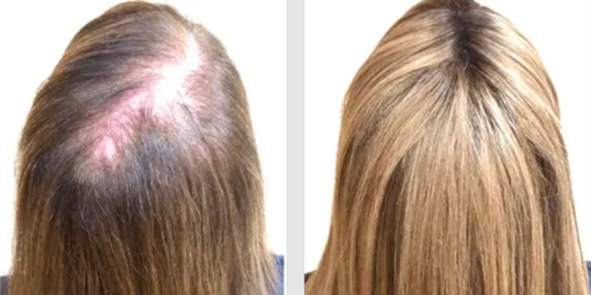 BioGrow Advanced Hair Regrowth US CA: Evaluating Core