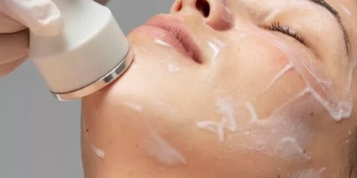 HIFU Treatment and Hair Regrowth Therapy at Veloura Clinic, Gurgaon