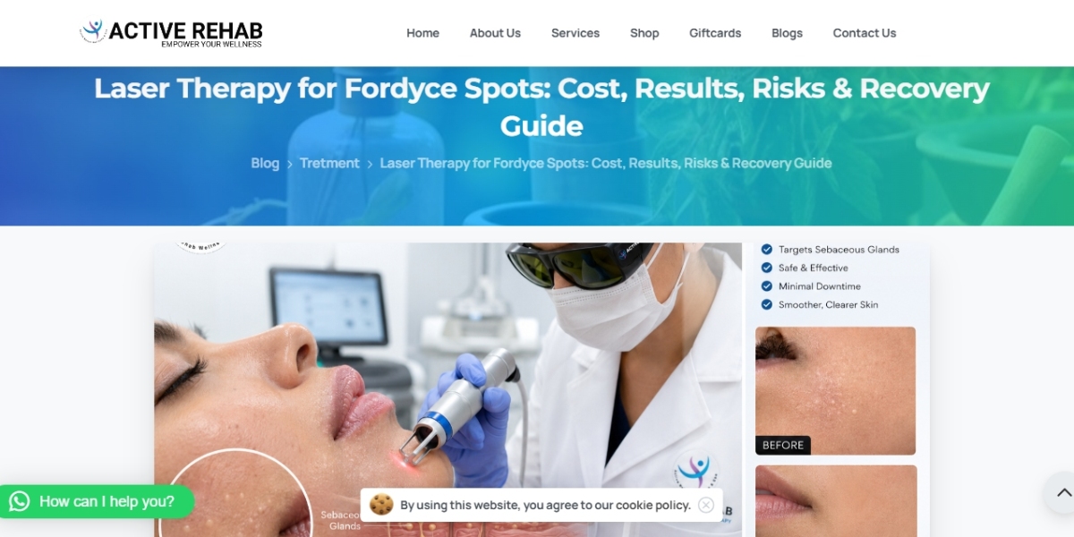 Laser Treatment for Fordyce Spots Cost: What Is the Best Way to Plan Your Treatment?
